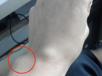 你的手表戴在腕骨之上还是之下？